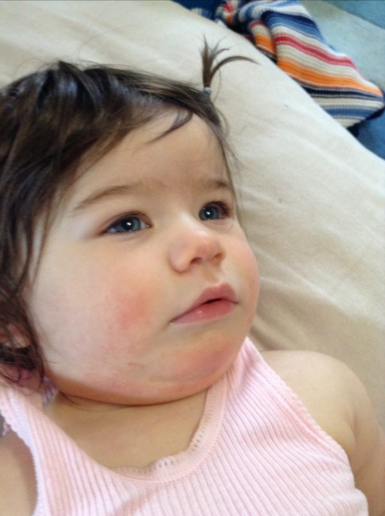 How It Works 2 ECZEMA ADELIN 21